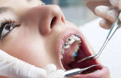 Как выбрать ортодонта
